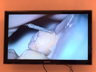 corso pratico dentista avanzato coraini nanussi